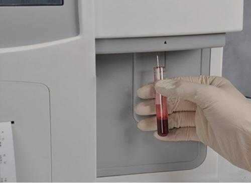 血常规检查的仪器叫什么-测血常规仪器叫什么-图3