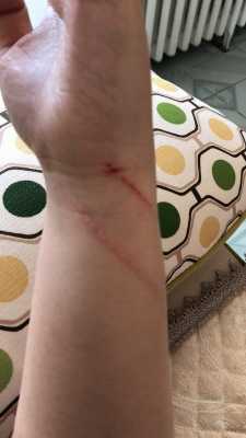  被打过疫苗的猫抓伤「被打过疫苗的猫抓伤出血要打狂犬疫苗吗」-图2