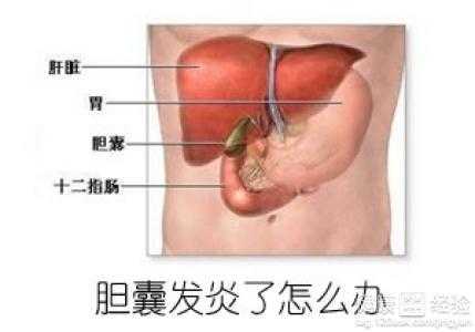 慢性胆囊炎 根治-图3